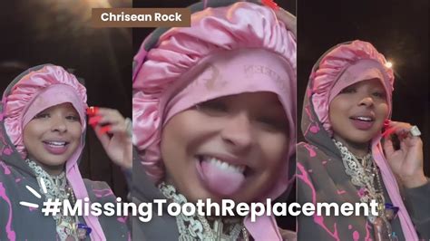 how did chrisean lose tooth|Chrisean Rock Reveals She Is Replacing Her Tooth。